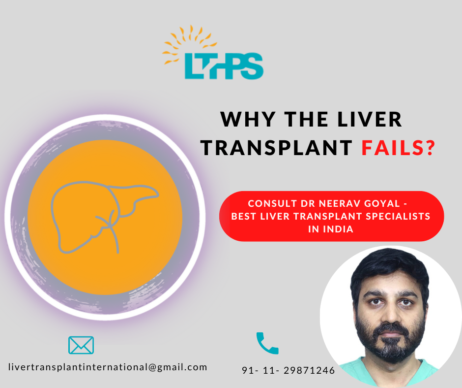 Liver Transplant Survival Rate by Age By Dr. NEERAV GOYAL