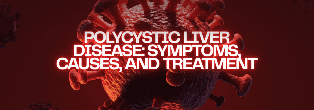 Polycystic Liver Disease Symptoms, Causes, and Treatment
