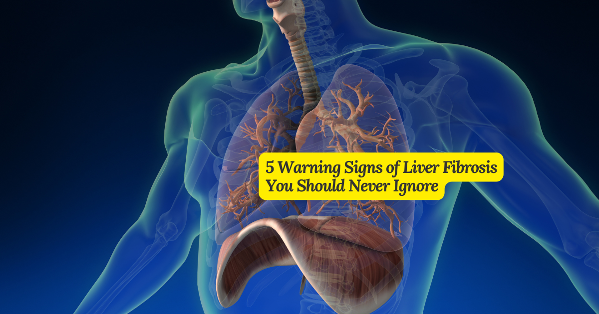 5-warning-signs-of-liver-fibrosis-you-should-never-ignore