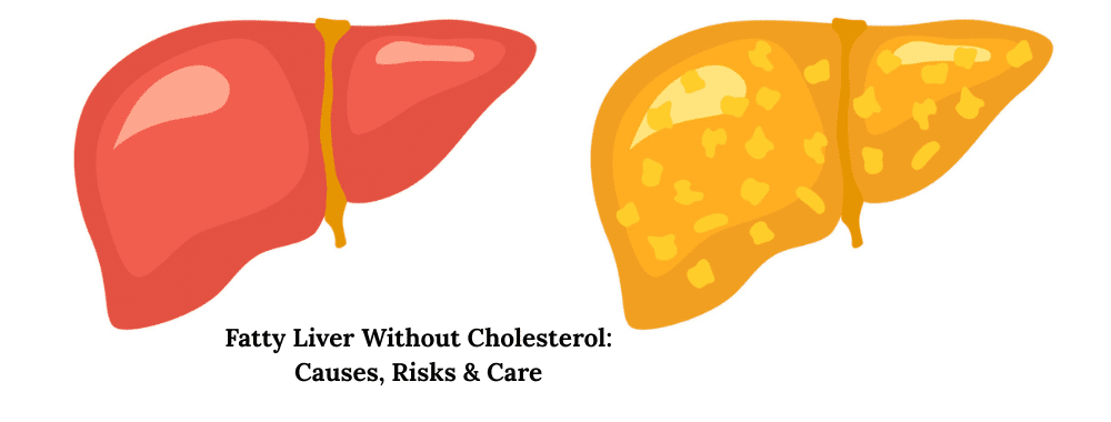 Fatty Liver Without Cholesterol Causes, Risks & Care (1)