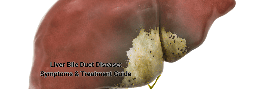 Liver Bile Duct Disease Symptoms & Treatment Guide