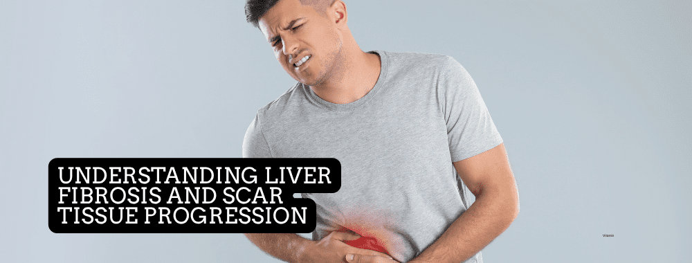Understanding Liver Fibrosis and Scar Tissue Progression