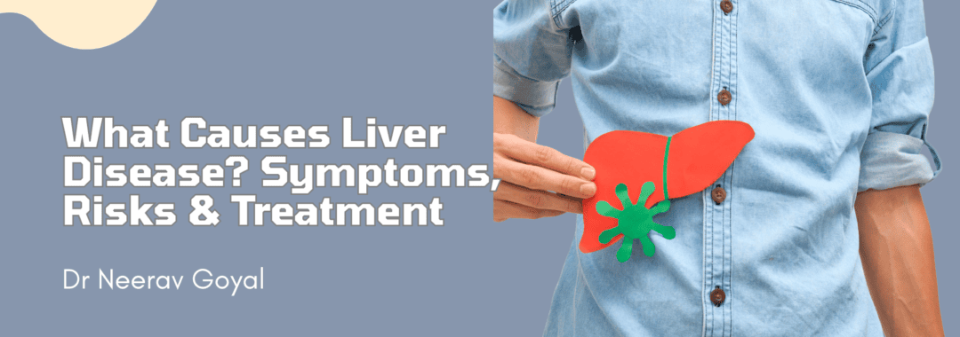 https://www.livertransplantinternational.com/what-causes-liver-disease-symptoms-risks-treatment/