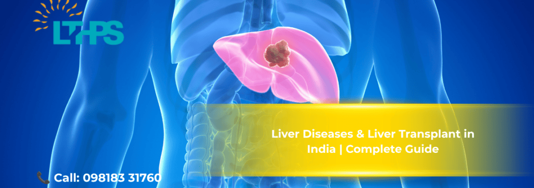 Liver Diseases & Liver Transplant in India Complete Guide
