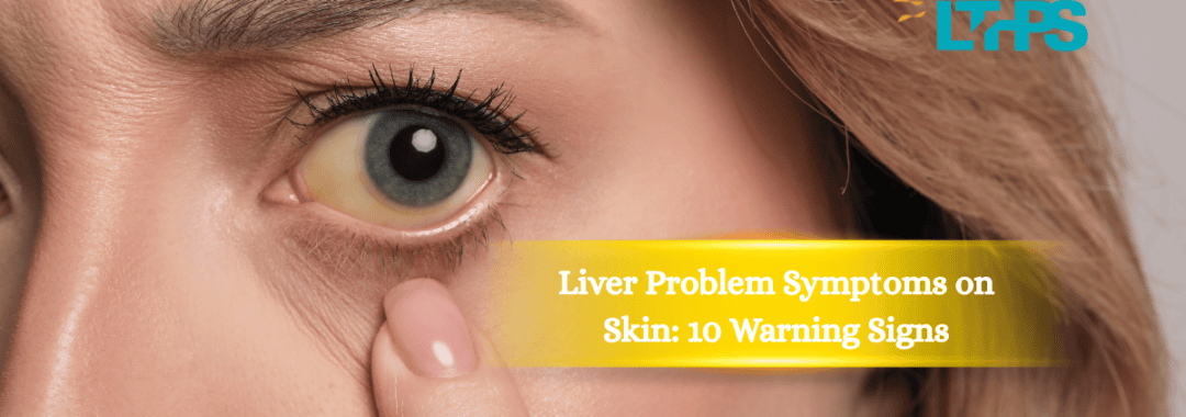 Liver Problem Symptoms on Skin 10 Warning Signs