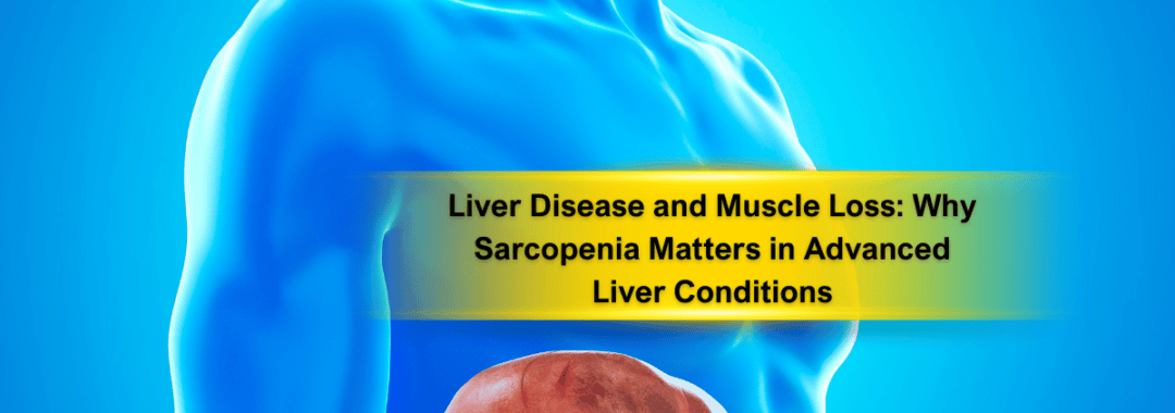 Liver Disease and Muscle Loss Why Sarcopenia Matters in Advanced Liver Conditions