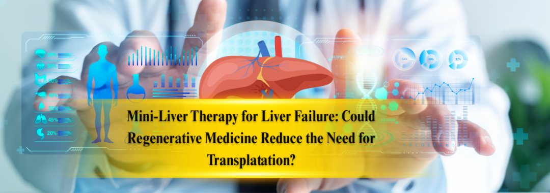 Mini-Liver Therapy for Liver Failure Could Regenerative Medicine Reduce the Need for Transplatation